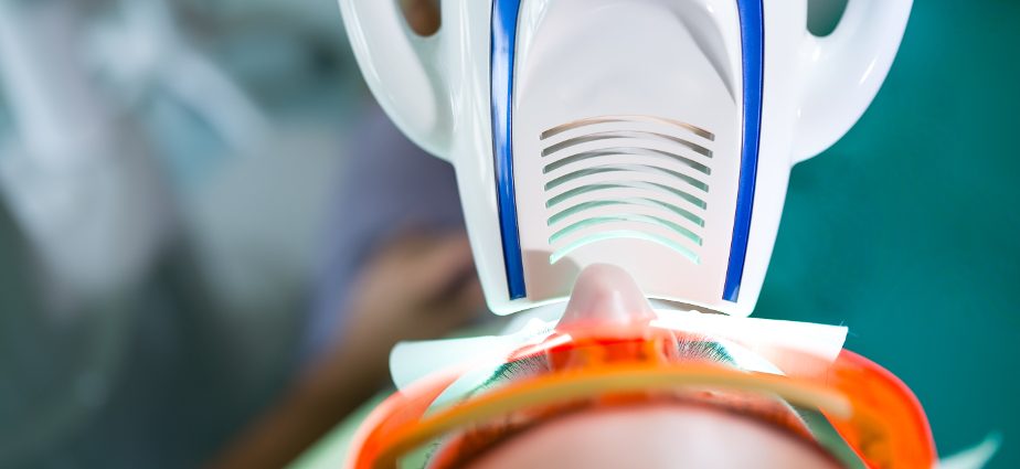Zoom teeth whitening omaha ne