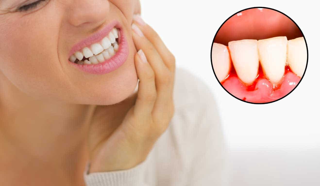 Gum Disease Treatment & Causes Omaha Dentist