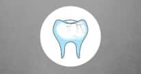 cracked tooth repair