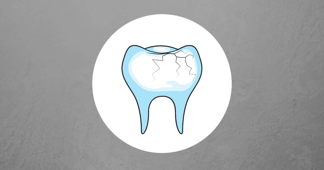 cracked tooth repair