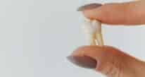 What to Do After a Tooth Falls Out?