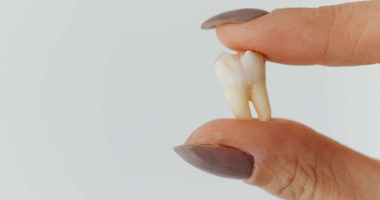 What to Do After a Tooth Falls Out?