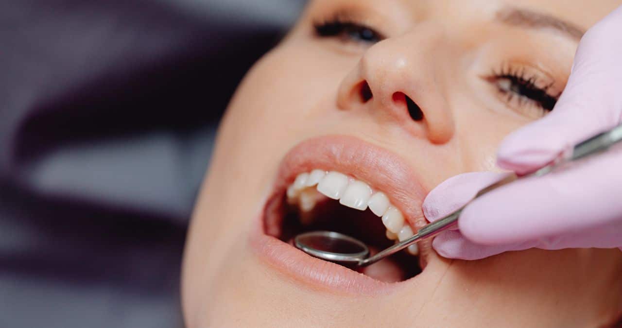 What is a Buccal Cavity?