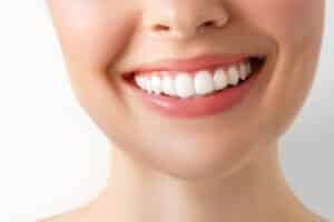 teeth whitening near me